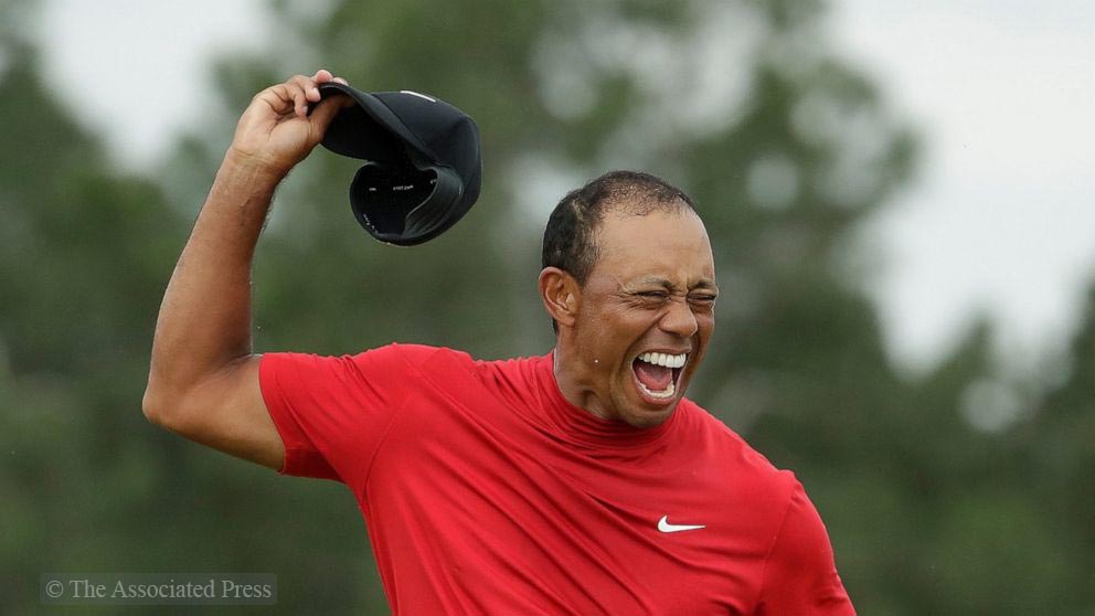 Tiger Woods Hair Loss