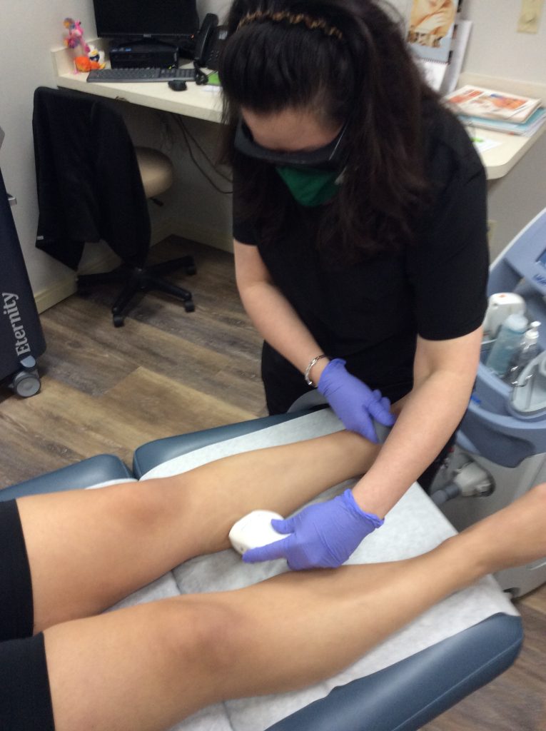 Laser Hair Removal Legs